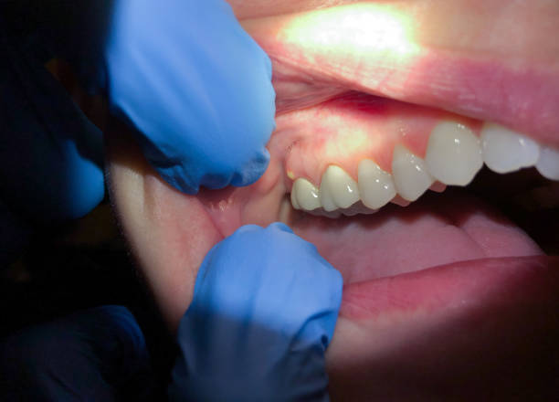 Best Pediatric Emergency Dentist in Minooka, IL