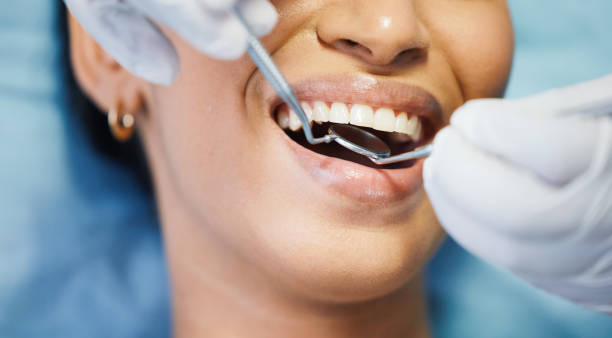 Best Emergency Dentist for Lost Fillings or Crowns in Minooka, IL