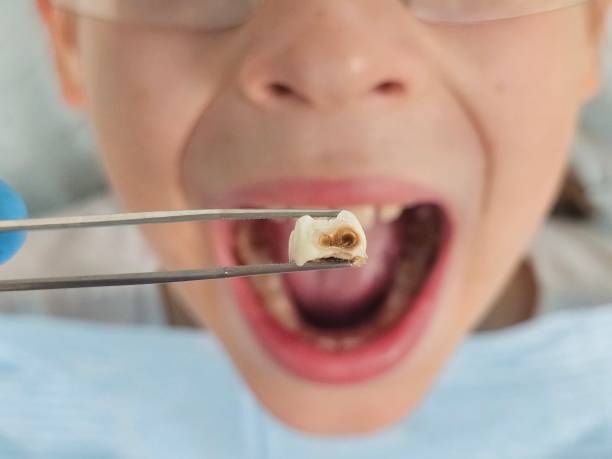 Best Mobile Emergency Dentist in Minooka, IL